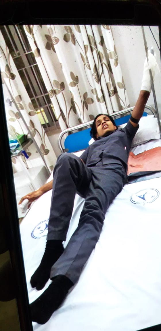 सनकी पति ने काटा पत्नी का हाथ