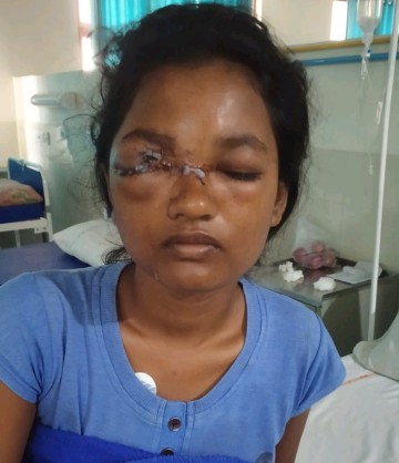 ट्रेन पत्थरबाजी में अपनी आंख गंवा चुकी वैशाली के परिजनों ने सीएम से लगाई गुहार, रेलवे दे नौकरी या मुआवजा 